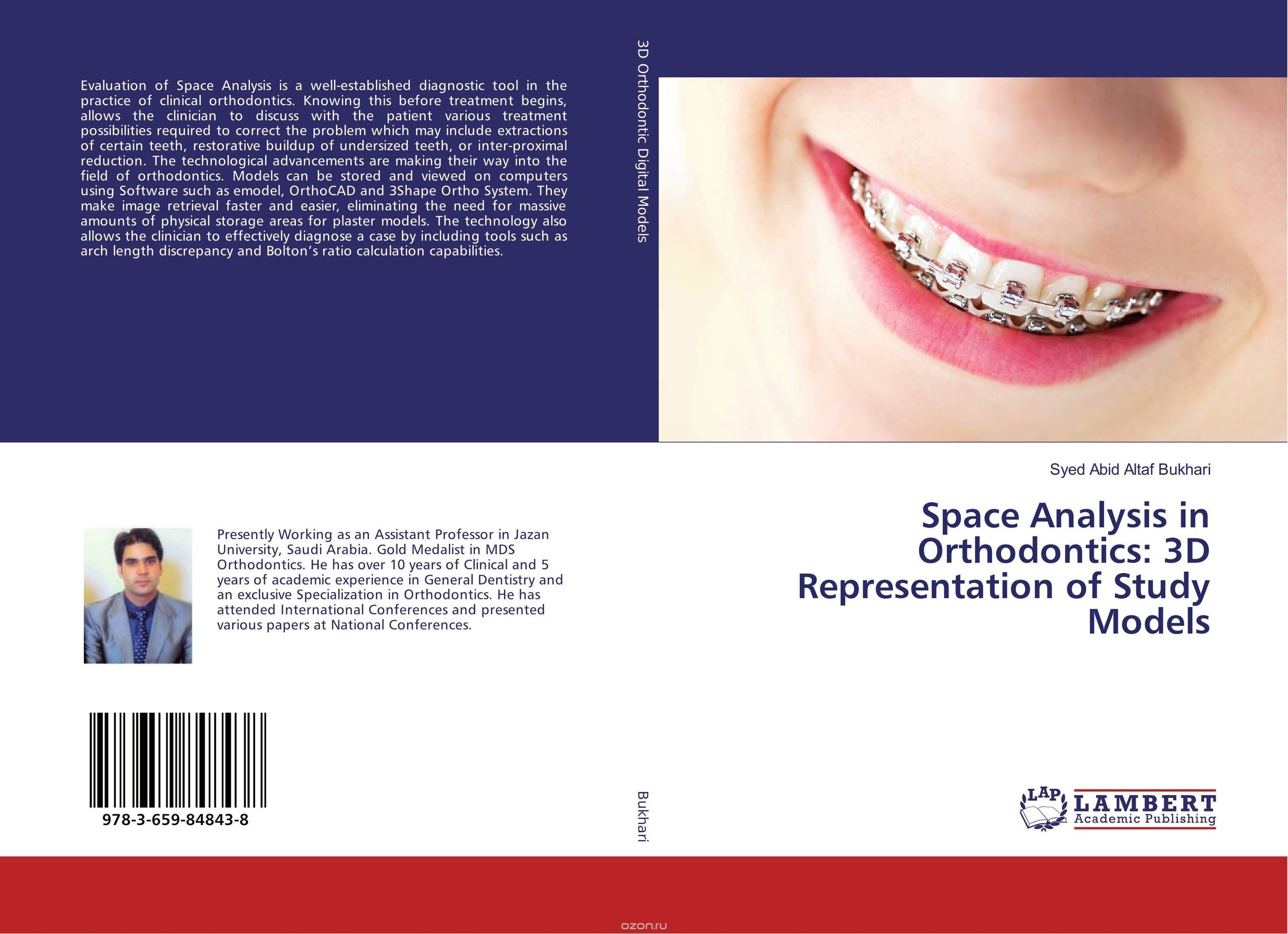Space Analysis in Orthodontics: 3D Representation of Study Models