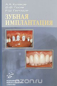 Скачать книгу "Зубная имплантация, А. А. Кулаков, Ф. Ф. Лосев, Р. Ш. Гветадзе"