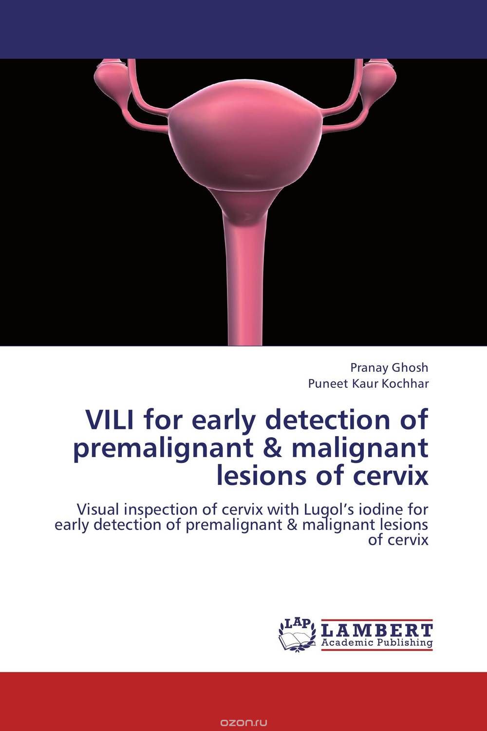 Скачать книгу "VILI for early detection of premalignant & malignant lesions of cervix"
