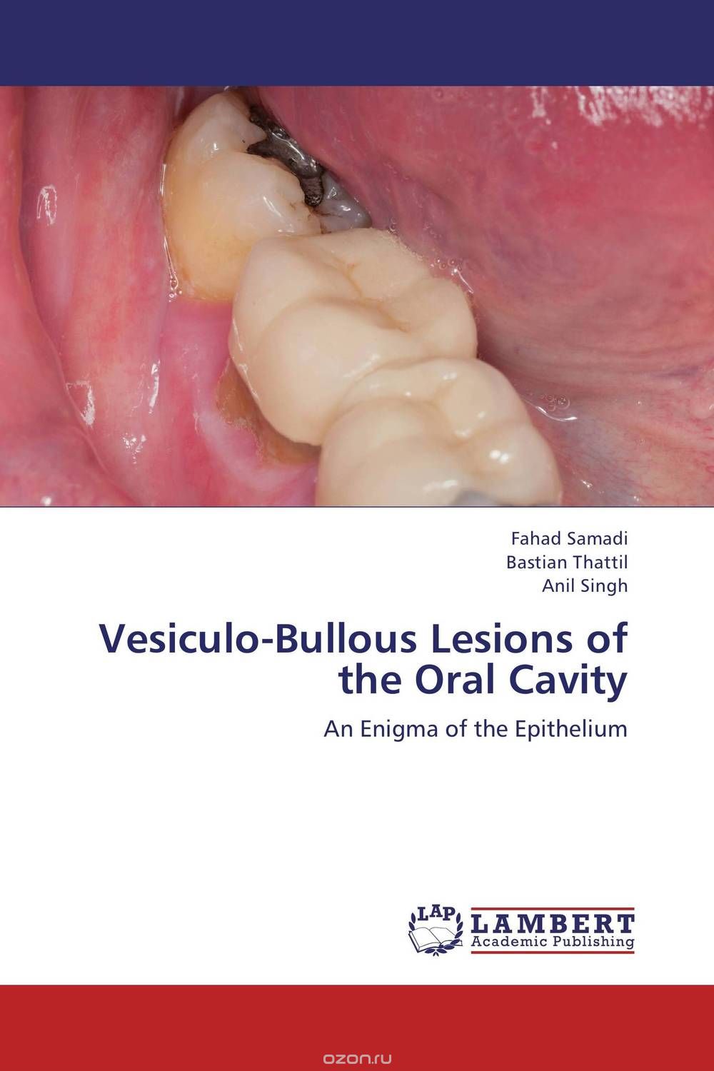 Скачать книгу "Vesiculo-Bullous Lesions of the Oral Cavity"